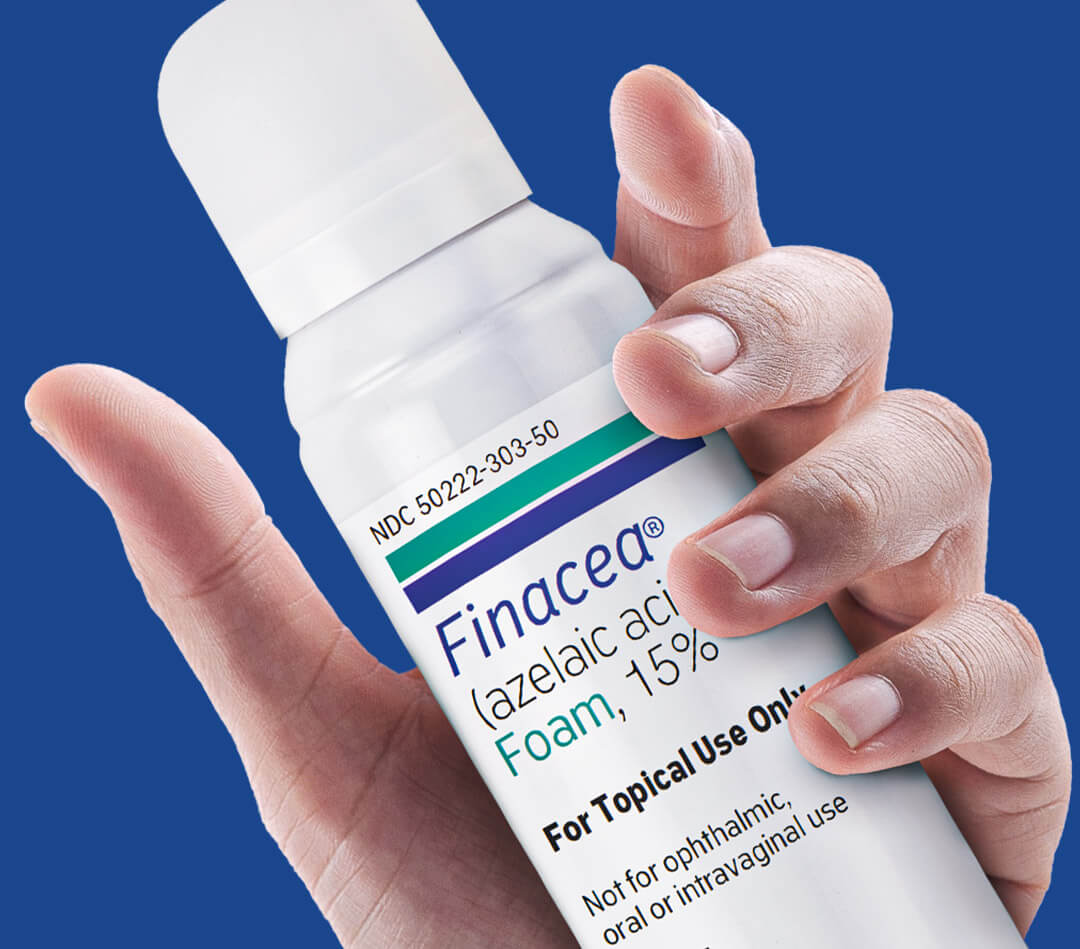 Hand holding Finacea® Foam